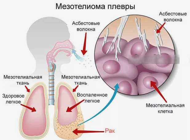 Вредность асбестовой пыли